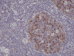 Anti-Aurora-B (AURKB) Rabbit Monoclonal Antibody [RM278] image 1