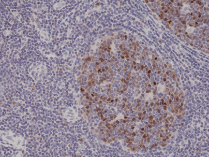 Anti-Aurora-B (AURKB) Rabbit Monoclonal Antibody [RM278] image 1