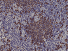 Anti-CD20 Rabbit Monoclonal Antibody [RM272] image 1