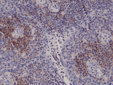 Anti-Integrin alpha 4 (ITGA4) Rabbit Monoclonal Antibody [RM268] image 1