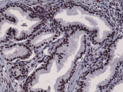 Anti-AR (N-terminal) rabbit monoclonal antibody [RM254] image 1