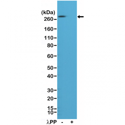 Anti-Phospho Acetyl CoA Carboxylase (S79) (ACC1) Rabbit Monoclonal Antibody [RM270] image 2
