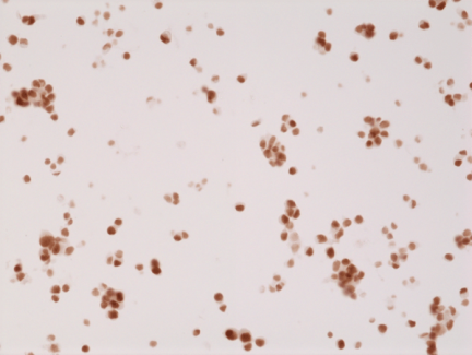 Anti-AR (N-terminal) rabbit monoclonal antibody [RM254] image 2