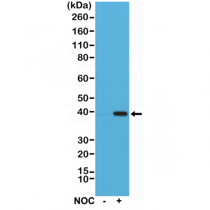 Anti-Aurora-B (AURKB) Rabbit Monoclonal Antibody [RM278] image 2