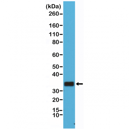 Anti-CD20 Rabbit Monoclonal Antibody [RM272] image 2