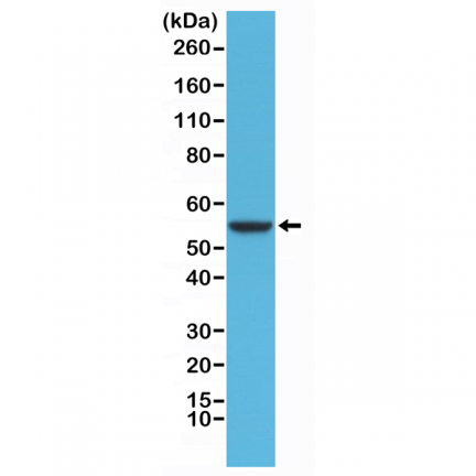 Anti-CK8 (Cytokeratin-8) Rabbit Monoclonal Antibody [RM266] image 2
