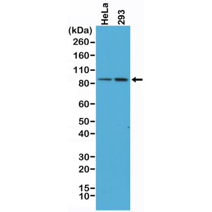 Anti-Beta-Catenin 1 (CTNNB1) Rabbit Monoclonal Antibody [RM276] image 2