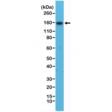 Anti-Integrin alpha 4 (ITGA4) Rabbit Monoclonal Antibody [RM268] image 2