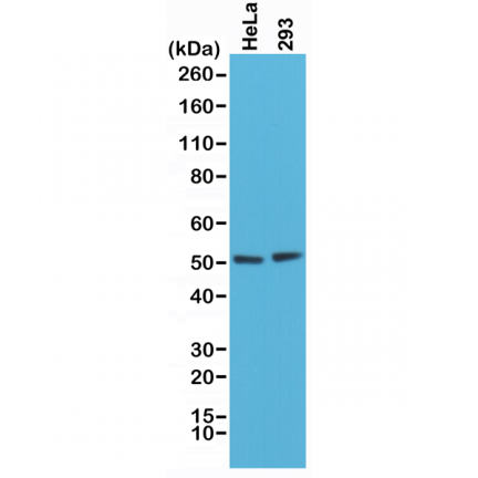 Anti-PTEN Rabbit Monoclonal Antibody [RM265] image 2