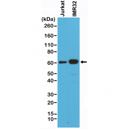Anti-Smad4 Rabbit Monoclonal Antibody [RM277] image 2