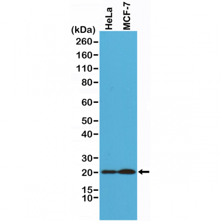 Anti-Smac/Diablo Rabbit Monoclonal Antibody [RM271] image 2
