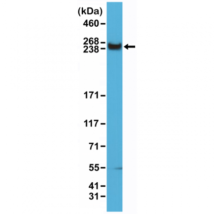 Anti-mTOR Rabbit Monoclonal Antibody [RM274] image 2