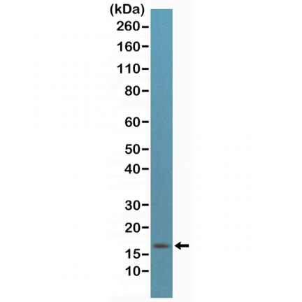Anti-p16INK4a (CDKN2A) Rabbit Monoclonal Antibody [RM267] image 2