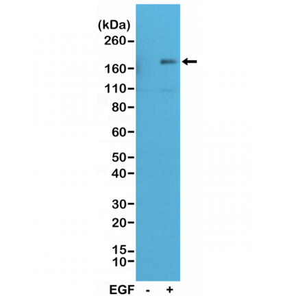 Anti-Phospho-EGFR (Y1173) Rabbit Monoclonal Antibody [RM269] image 2