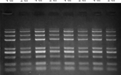 PCR Purification Kit Comparison – DNA Clean Up