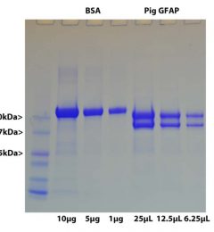 GFAP Protein - Prot-p-GFAP Image 1