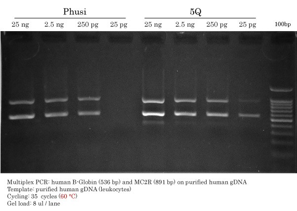 Detection Limit of High-Fidelity DNA Polymerases 25ng to 25pg Phusion vs Q5
