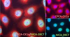 Casein Kinase 1 α Antibody - CPCA-CK1α Image 1