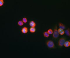Aurora A Kinase Antibody - MCA-1A14 Image 1