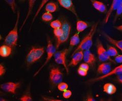 Aurora B Kinase Antibody - MCA-3F11 Image 1