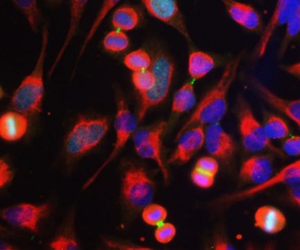 Aurora B Kinase Antibody - MCA-3F11 Image 1