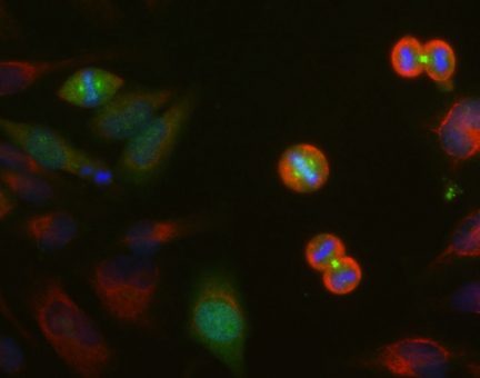 Aurora A/B/C Kinase Antibody - MCA-4A7 Image 1