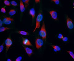 Aurora B Kinase Antibody - MCA-6G2 Image 1