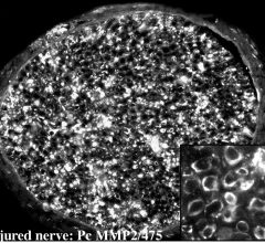 MMP2 Antibody - RPCA-MMP2 Image 1