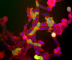 Neuron Specific Enolase Antibody - RPCA-NSE Image 1