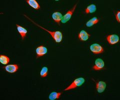 Vimentin Antibody - RPCA-Vim Image 1
