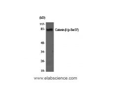 Phospho-Catenin-β (Ser37) Polyclonal Antibody - E-AB-20828 image 1