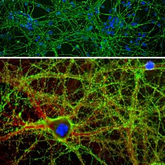 CPCA-GAP43 + RPCA-Spectrin IF ICC on neurons