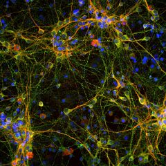 CPCA-Tau + MCA-4H5 MAP2 neurons IF/ICC