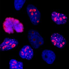 Human Ki67 Mouse Monoclonal Antibody - MCA-6G3 HeLa cells IF