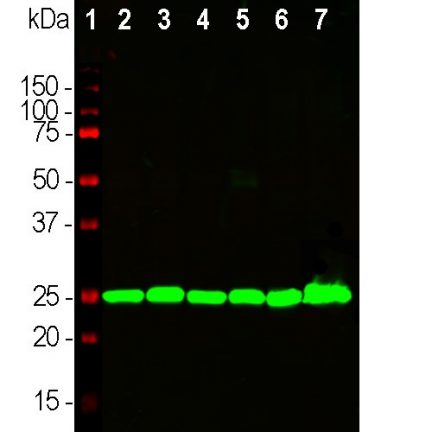 Mouse Monoclonal Antibody to UCHL1 Cat# MCA-BH7 WB