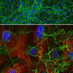 RPCA-GAP43 + MCA-2A52 Vimentin ICC on neurons
