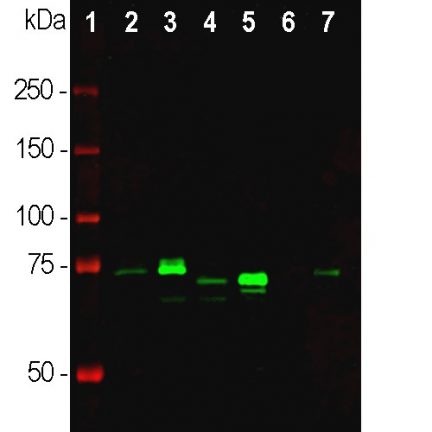 Rabbit Polyclonal Antibody to MeCP2 Cat# RPCA-MeCP2 WB