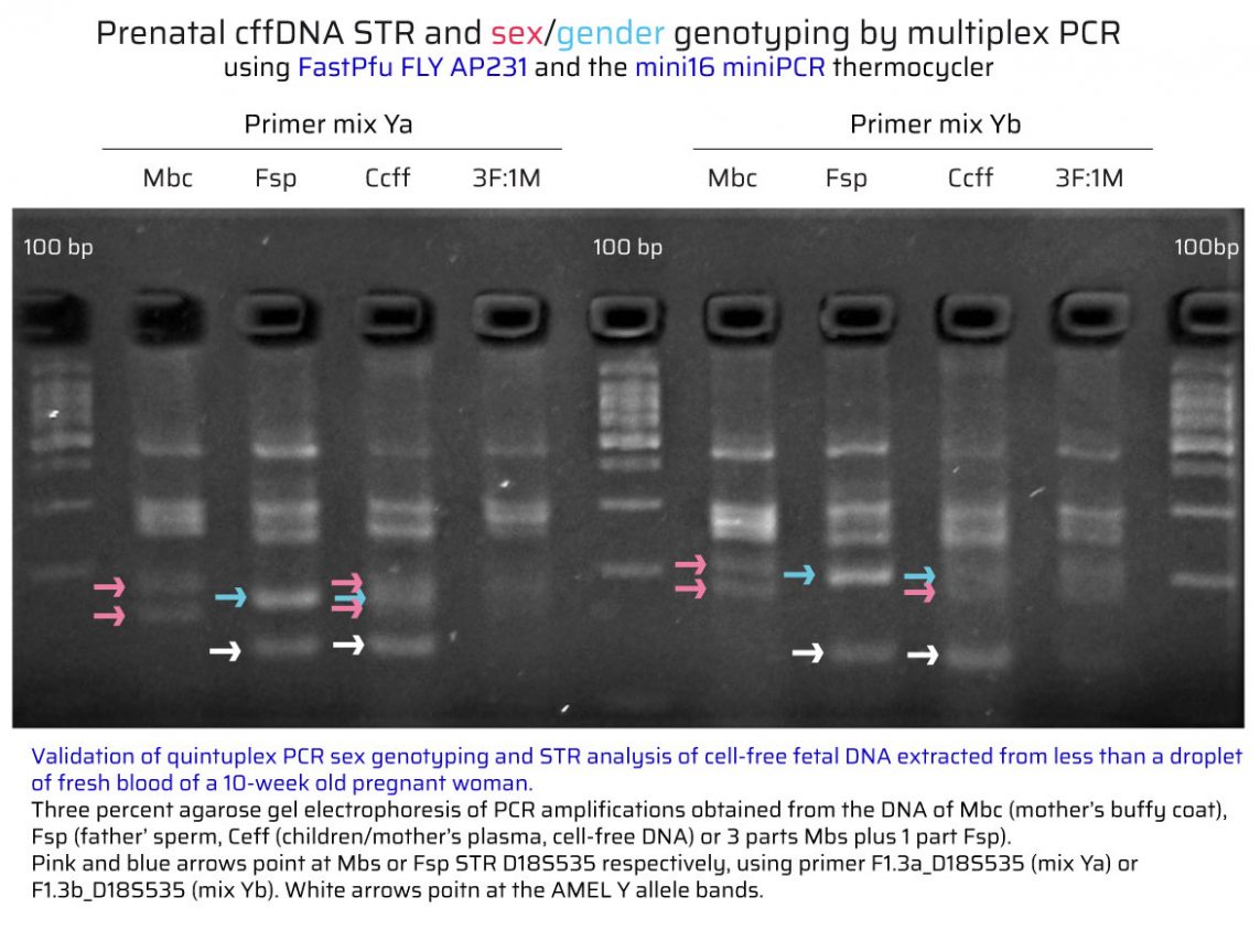Validation of quintuplex PCR sex genotyping and STR analysis of cell-free fetal DNA
