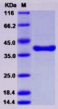 Recombinant Human ARG1 / Arginase 1 Protein (His & MYC Tag)