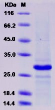 Recombinant Human CD20 / MS4A1 Protein (TrxA Tag)