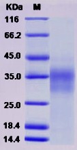 Recombinant Human CD153 / CD30L / TNFSF8 Protein