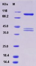 Recombinant Human AMPK (G1/B1/A2) Heterotrimer Protein