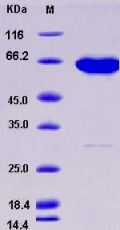 Recombinant Human ADK Protein (His & GST tag)