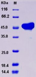 Recombinant Human AK4 / Adenylate Kinase 4 / AK3L1 Protein (His & GST tag)