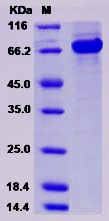 Recombinant Human AKT2 / protein kinase B / PKB beta Protein (His & GST tag)