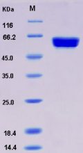 Recombinant Human CAMK1D / CKLiK Protein (GST tag)