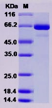 Recombinant Human SMPD1 Protein (His Tag)