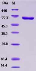 Recombinant Human ACK1 / TNK2 Protein (GST tag)