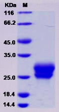 Recombinant Human Frizzled-4 / FZD4 / CD344 Protein (His Tag)