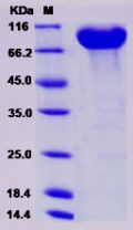 Recombinant Human CADM4 / IGSF4C / NECL-4 Protein (Fc Tag)